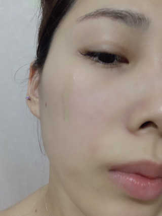 셀리맥스 노니 에너지 앰플 — 5점을 준 리뷰어가 2019년 8월 올린 사용 사진