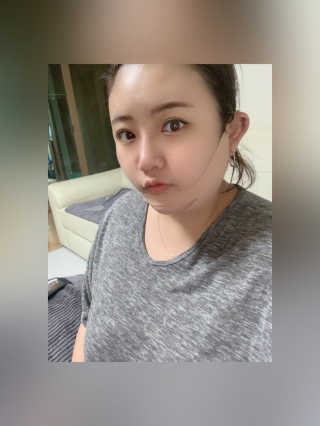 아이디플라코스메틱 아이디 페이스핏 마이너스 밴드 — 5점을 준 리뷰어가 2019년 11월 올린 사용 사진