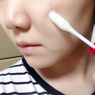 나이팅게일 토닝이레이저 — 4점을 준 리뷰어가 2016년 11월 올린 사용 사진