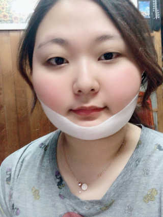 스케덤 클루덤 리프팅 패치 — 5점을 준 리뷰어가 2019년 4월 올린 사용 사진
