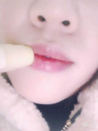 메디미 에코립스 유기농 립밤3종 랜덤배송 — 5점을 준 리뷰어가 2017년 1월 올린 사용 사진
