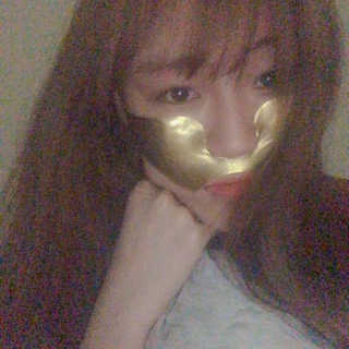 [스케덤] 상악밴드 — 3.5점을 준 리뷰어가 2019년 5월 올린 사용 사진