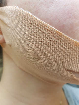 아이디플라코스메틱 아이디 페이스핏 마이너스 밴드 — 4점을 준 리뷰어가 2019년 10월 올린 사용 사진