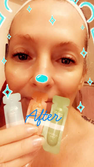 아이뽀 모든 피부 타입을위한 AIPPO Expert Hydrating Mask — 5점을 준 리뷰어가 2018년 3월 올린 사용 사진