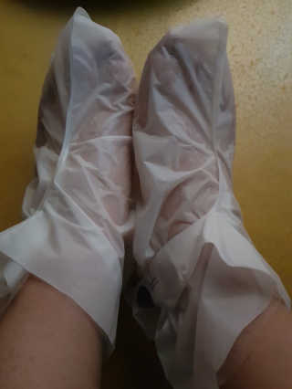 OMYLIFE Skin Freyia Foot Peeling — 5점을 준 리뷰어가 2018년 6월 올린 사용 사진