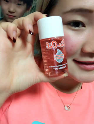 Bio-oil(바이오오일) 바이오오일(Bio-oil) — 4.5점을 준 리뷰어가 2017년 1월 올린 사용 사진