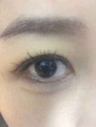 나이팅게일 데일리 더마 클렌징패드 마일드 — 2.5점을 준 리뷰어가 2018년 12월 올린 사용 사진