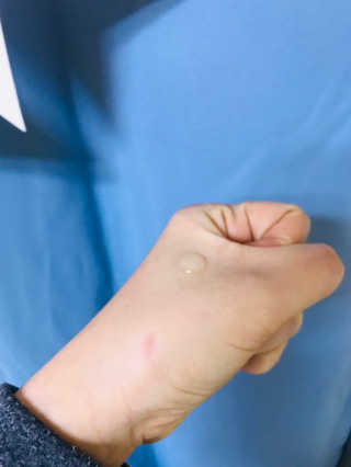 AHC 에이 에이치 씨 미니멀 10 워터리 에센스 — 4점을 준 리뷰어가 2018년 12월 올린 사용 사진