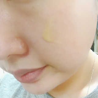 보타니티 [홍]조[진]정[결]케어 플라본 세럼 — 5점을 준 리뷰어가 2018년 5월 올린 사용 사진