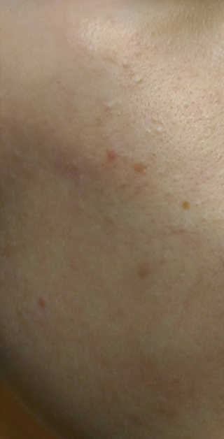 엘리자베카 Elizavecca Witch Piggy Hell-pore EGF 스페셜 앰플 — 5점을 준 리뷰어가 2018년 4월 올린 사용 사진