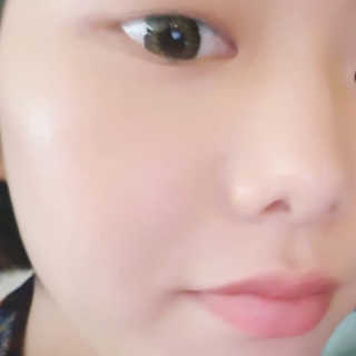 [더마허브] 주사팩 5종, 물광,백옥,태반,신데렐라 등 — 5점을 준 리뷰어가 2018년 3월 올린 사용 사진