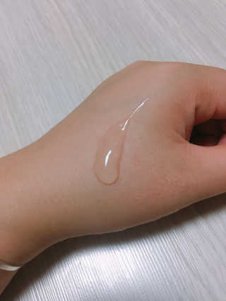 아이소이 파란소화기 응급스팟 — 3점을 준 리뷰어가 2017년 8월 올린 사용 사진