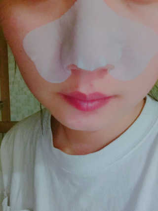 나이팅게일 TAKO PACK NOSE [문어코팩] — 3점을 준 리뷰어가 2017년 4월 올린 사용 사진