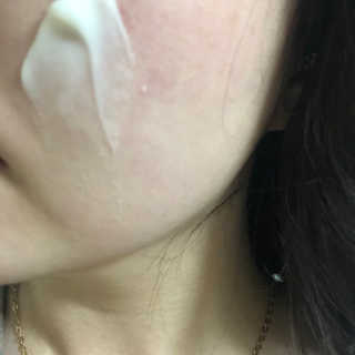 아크웰 아쿠아 클리니티 수분크림 — 4.67점을 준 리뷰어가 2018년 10월 올린 사용 사진
