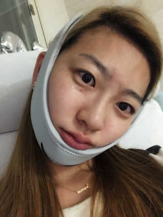 메디미 브이미 업 2스텝 브이라인벨트 — 4.5점을 준 리뷰어가 2017년 6월 올린 사용 사진