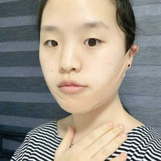아이디플라코스메틱 아이디 페이스핏 마이너스 밴드 — 5점을 준 리뷰어가 2020년 1월 올린 사용 사진
