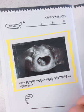 hyojoomommy님이 올린 리뷰 사진 2