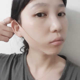 아이디플라코스메틱 아이디 페이스핏 마이너스 밴드 — 2점을 준 리뷰어가 2019년 9월 올린 사용 사진