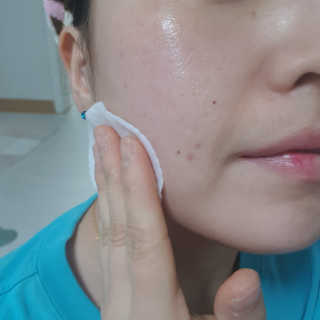 비알티씨 V10 필링패드 — 4.83점을 준 리뷰어가 2019년 1월 올린 사용 사진