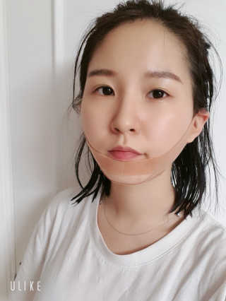 아이디플라코스메틱 아이디 페이스핏 마이너스 밴드 — 4.5점을 준 리뷰어가 2020년 1월 올린 사용 사진