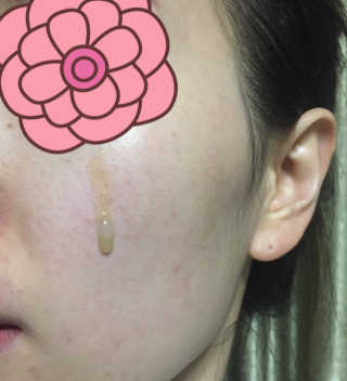 보타니티 [홍]조[진]정[결]케어 플라본 세럼 — 3.83점을 준 리뷰어가 2018년 5월 올린 사용 사진