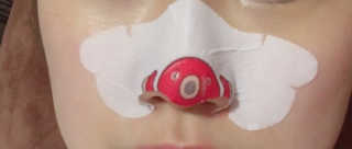 나이팅게일 TAKO PACK NOSE [문어코팩] — 3.5점을 준 리뷰어가 2017년 4월 올린 사용 사진