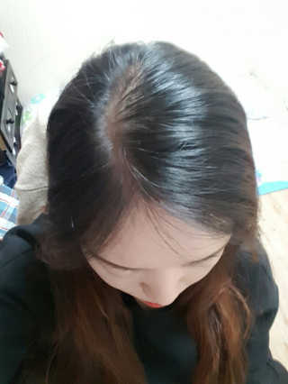 다슈코리아 다슈 데일리 헤어라인 커버 쿠션 — 3점을 준 리뷰어가 2017년 4월 올린 사용 사진
