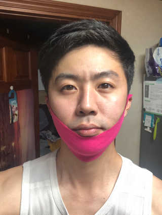 스케덤 펩타이드 리프팅밴드 — 5점을 준 리뷰어가 2019년 6월 올린 사용 사진