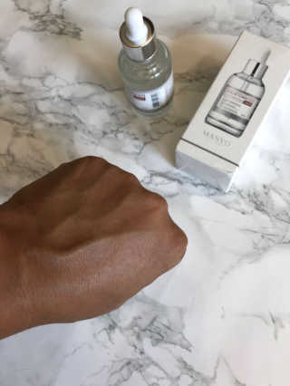 [마녀 공장] 발가락 토미 니아신 에센스 50ml — 5점을 준 리뷰어가 2018년 8월 올린 사용 사진