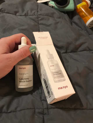 [마녀 공장] 발가락 토미 니아신 에센스 50ml — 5점을 준 리뷰어가 2019년 3월 올린 사용 사진