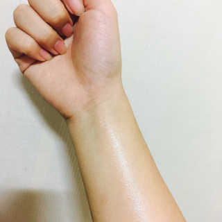 Bio-oil(바이오오일) 바이오오일 — 5점을 준 리뷰어가 2016년 10월 올린 사용 사진