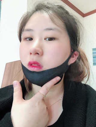 어웨이크어슬립 어슬립 페이스 리프트업 밴드 — 4.33점을 준 리뷰어가 2018년 5월 올린 사용 사진