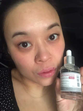 [마녀 공장] 발가락 토미 니아신 에센스 50ml — 3점을 준 리뷰어가 2019년 1월 올린 사용 사진