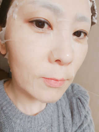 보타메디 씨놀®미라클마스크팩 — 5점을 준 리뷰어가 2018년 11월 올린 사용 사진