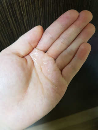 (주)에네스티 미스랩 갈락토미세스 클리어 플러스 에센스 — 5점을 준 리뷰어가 2020년 1월 올린 사용 사진