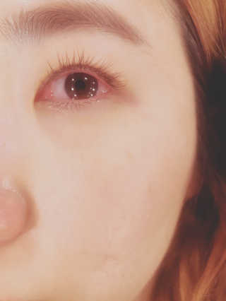 Viewty Skin and Lash [ViewtySkin＆Lash] 종아리 림프순환 부종관리 — 1점을 준 리뷰어가 2019년 4월 올린 사용 사진