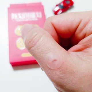 캐치미패치 트러블 스팟패치 — 5점을 준 리뷰어가 2019년 12월 올린 사용 사진