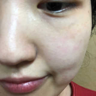 글로우힐 퓨어 필 하이드레이트 크림 — 3.67점을 준 리뷰어가 2018년 10월 올린 사용 사진
