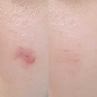 딱지웜님이 올린 리뷰 사진 2