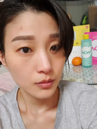 온가족 수분뿜뿜 노랑뚜껑 재주꾼 와우374 스네일토너 — 5점을 준 리뷰어가 2019년 11월 올린 사용 사진