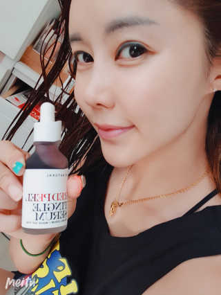 쏘내추럴 레드 필 팅글 세럼 오리지널 — 5점을 준 리뷰어가 2019년 8월 올린 사용 사진