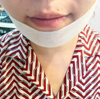 스케덤 클루덤 리프팅 패치 — 5점을 준 리뷰어가 2019년 3월 올린 사용 사진