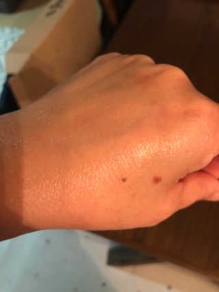메디필 에스테 더마 레드마린 콜라겐 토너 — 4점을 준 리뷰어가 2020년 1월 올린 사용 사진