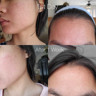 skinstory님이 올린 리뷰 사진 2