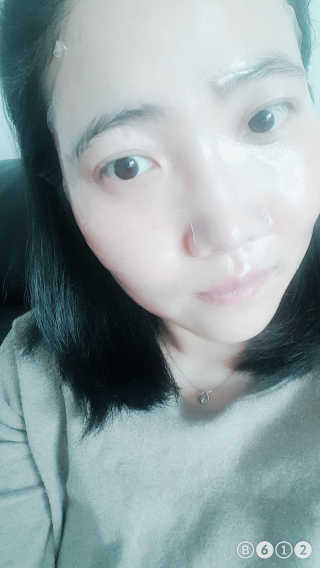 [더마허브] 주사팩 5종, 물광,백옥,태반,신데렐라 등 — 5점을 준 리뷰어가 2018년 3월 올린 사용 사진