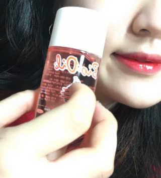 Bio-oil(바이오오일) 바이오오일 — 3.5점을 준 리뷰어가 2016년 9월 올린 사용 사진