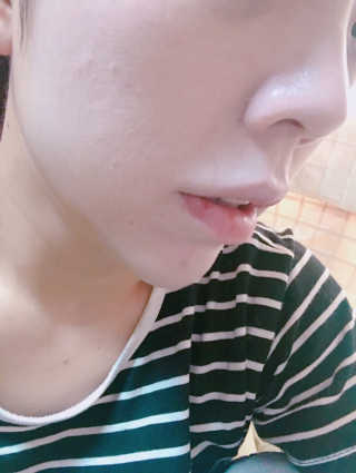파시스 올인원 진주 화이트닝 크림 100ml — 5점을 준 리뷰어가 2019년 5월 올린 사용 사진