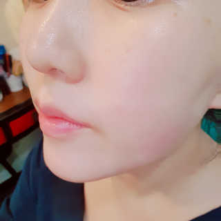 지고트 비타솔루션12 모이스처 앰플 크림 100ml — 4점을 준 리뷰어가 2019년 7월 올린 사용 사진