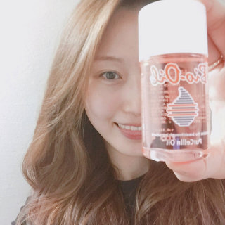 Bio-oil(바이오오일) 바이오오일(Bio-oil) — 5점을 준 리뷰어가 2016년 8월 올린 사용 사진