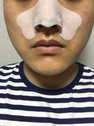 나이팅게일 TAKO PACK NOSE [문어코팩] — 4.83점을 준 리뷰어가 2017년 5월 올린 사용 사진